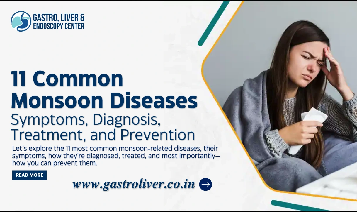 11 Monsoon Diseases: Causes, Diagnosis & Prevention Tips