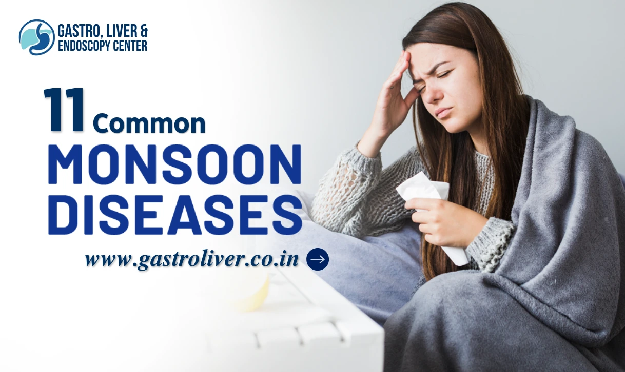 11 Common Monsoon Diseases: Symptoms, Diagnosis, Treatment, and Prevention