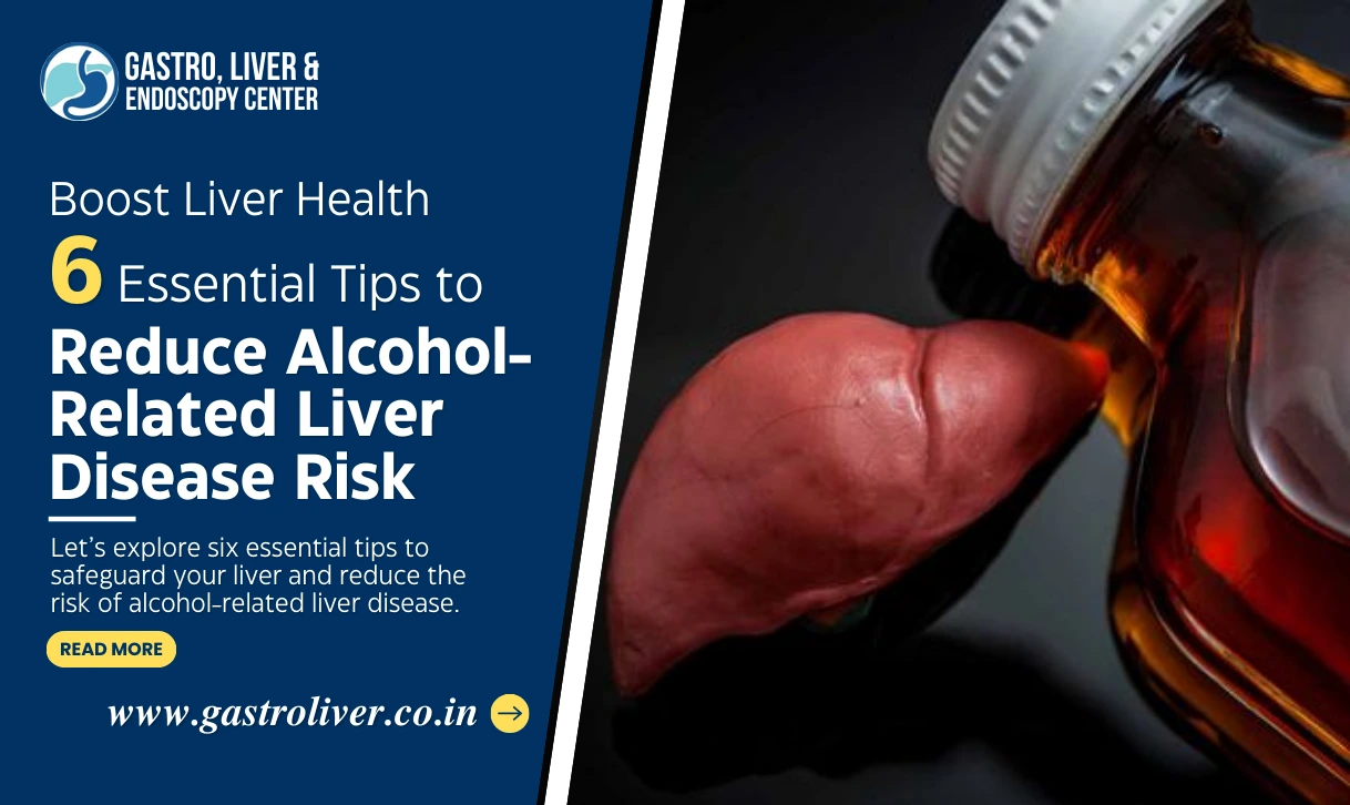 6 Essential Tips to Reduce Alcohol‑Related Liver Disease Risk