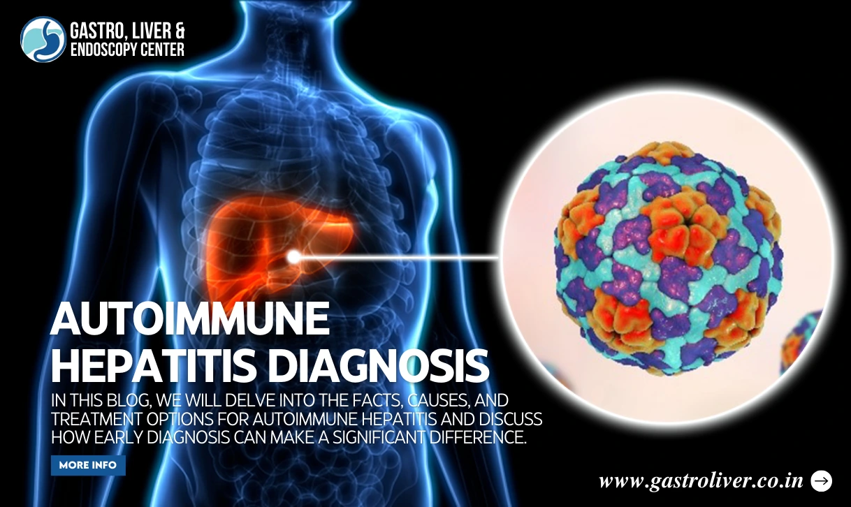 Autoimmune Hepatitis Diagnosis: Facts, Treatment, and Causes