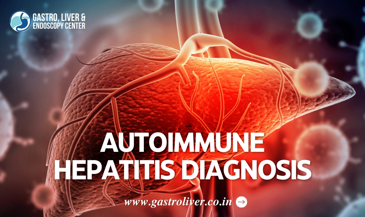 Autoimmune Hepatitis Diagnosis: Facts, Treatment, and Causes