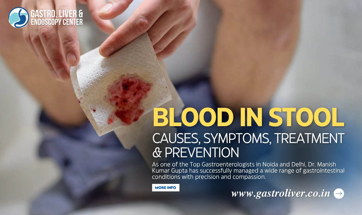 Blood in Stool – Causes, Symptoms, Treatment & Prevention