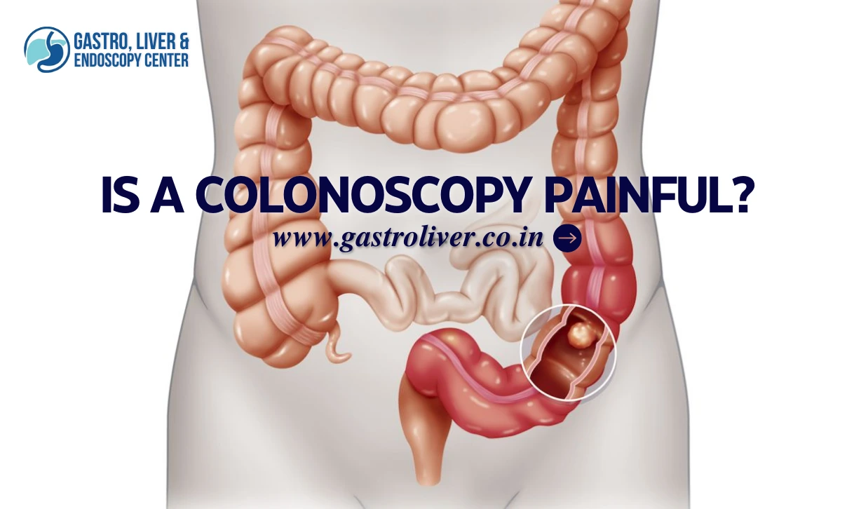 Is a Colonoscopy Painful?