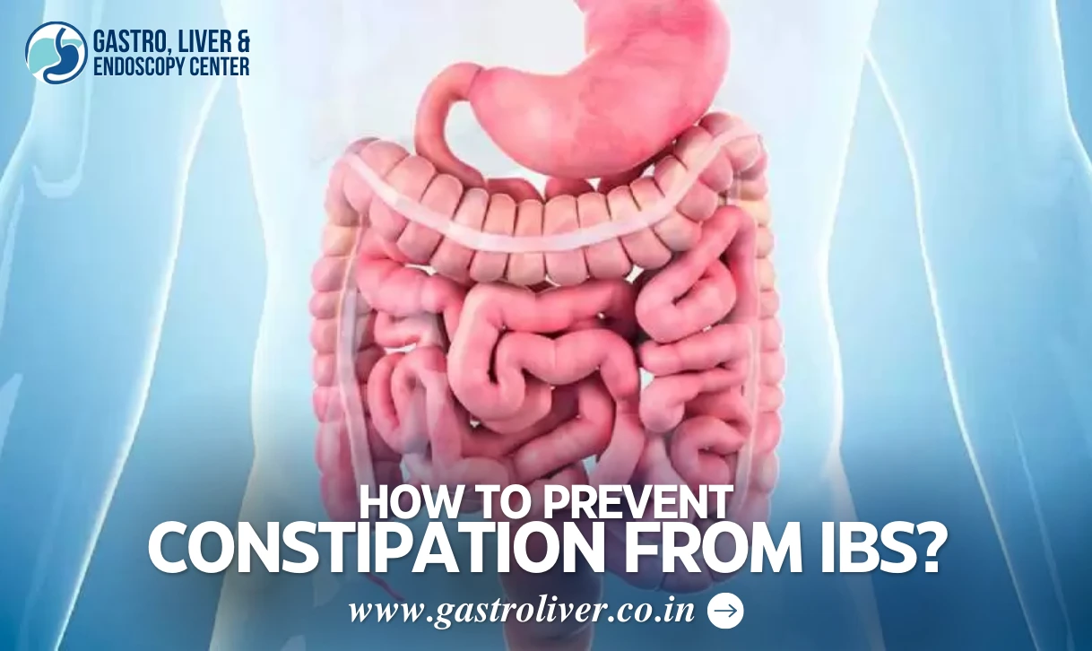 How to Prevent Constipation from IBS?