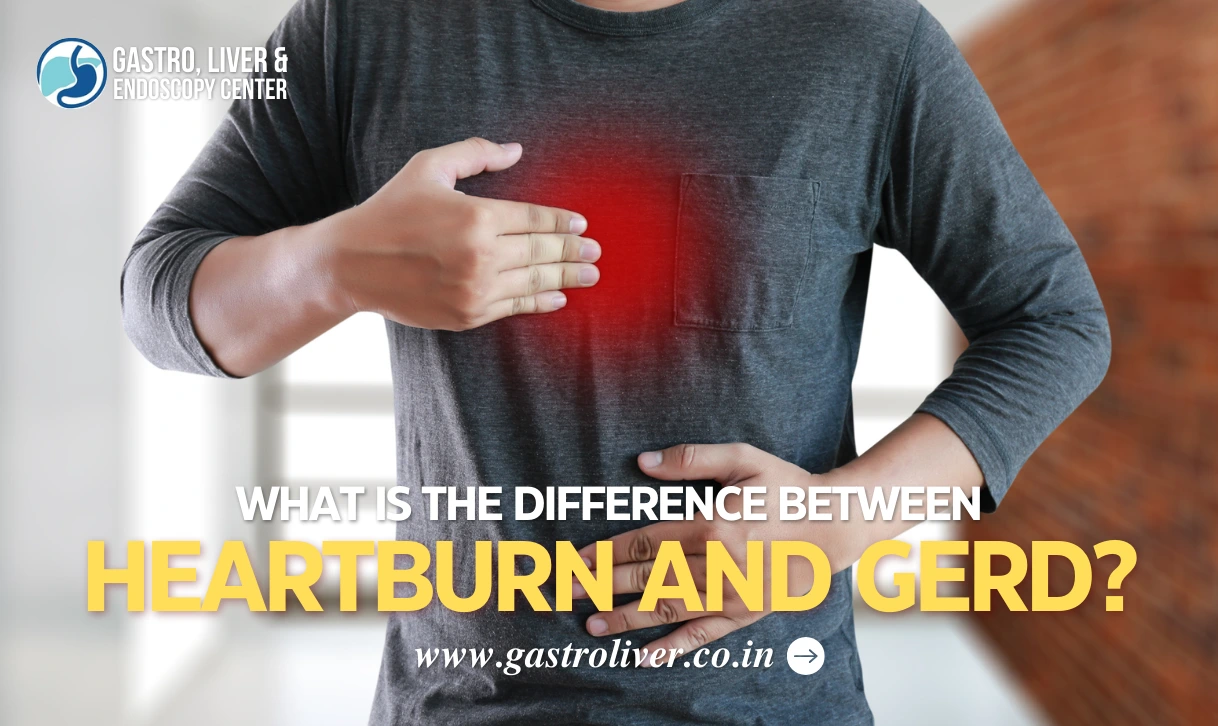 What is the Difference between Heartburn and GERD