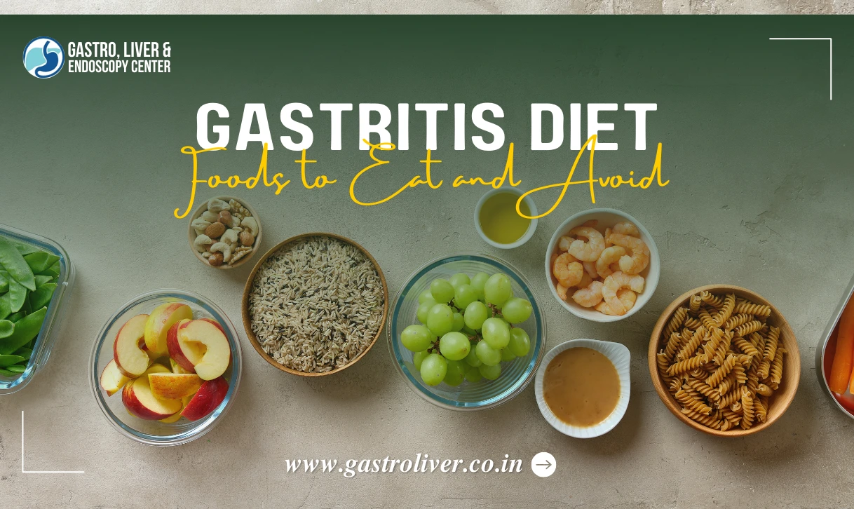 Gastritis Diet: Foods to Eat and Avoid