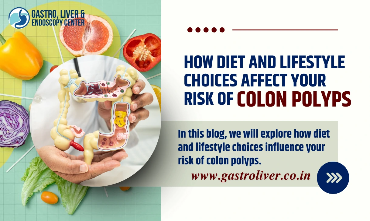How Diet and Lifestyle Choices Affect Your Risk of Colon Polyps