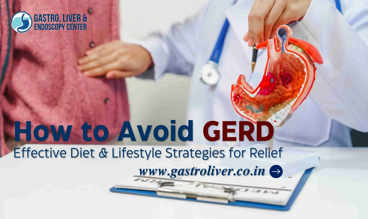 How to Avoid GERD: Effective Diet & Lifestyle Strategies for Relief