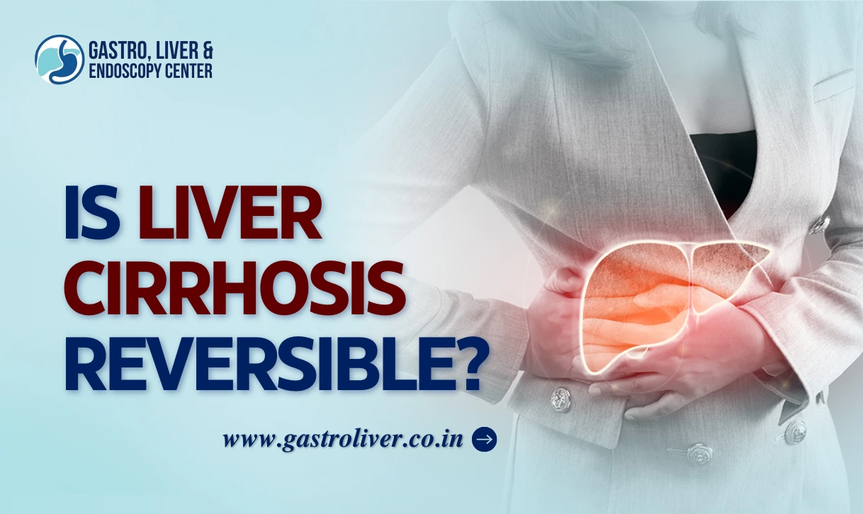Is Liver Cirrhosis Reversible? What You Must Understand
