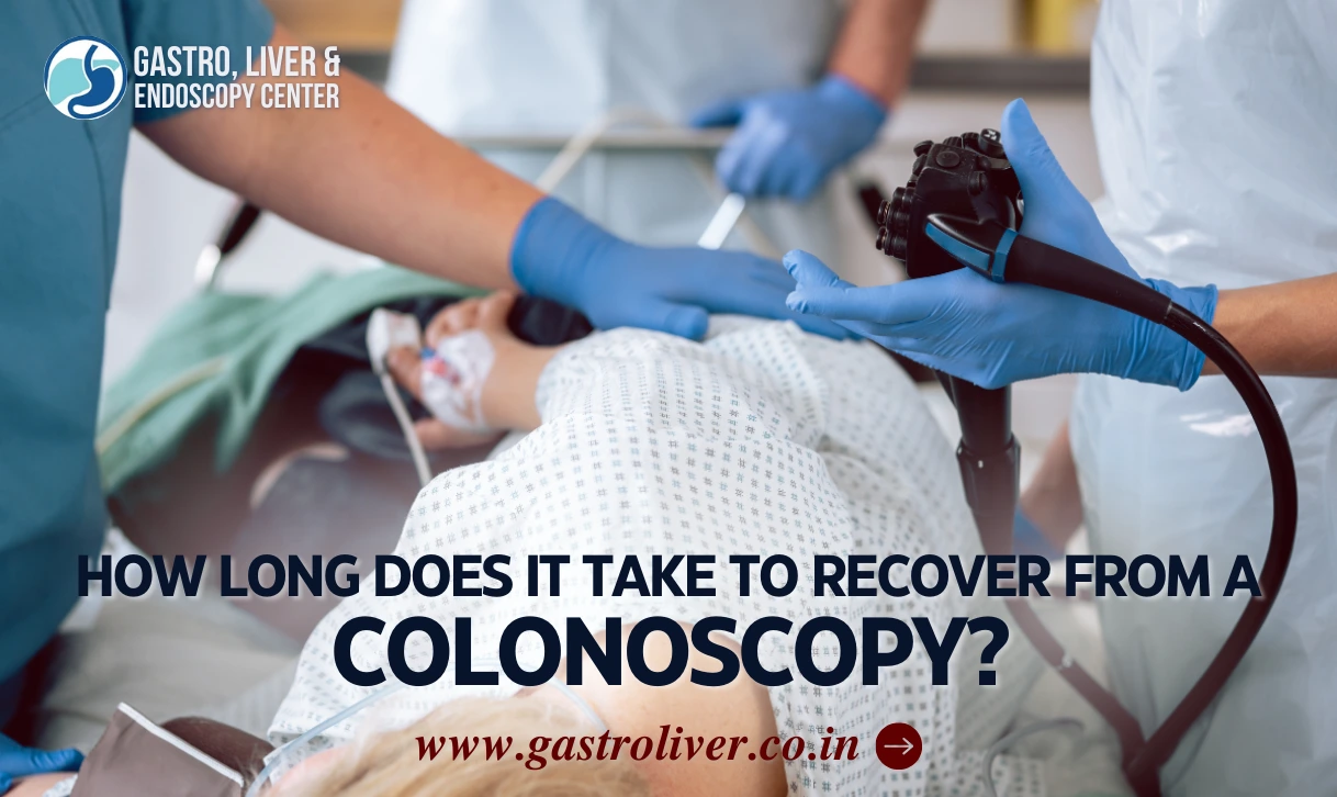 How long does it take to recover from a Colonoscopy?