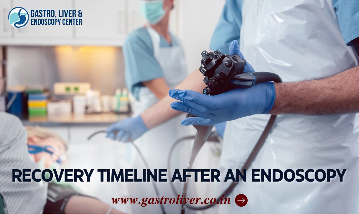 Recovery Timeline after an Endoscopy