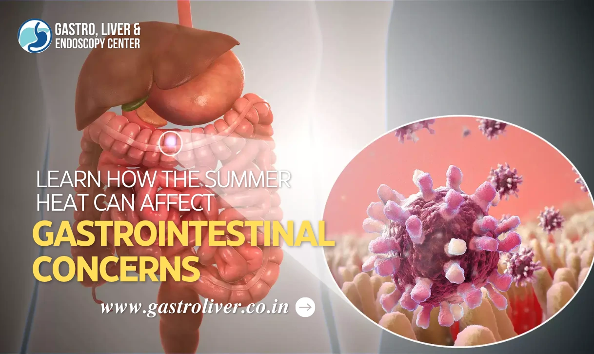 Learn How the Summer Heat Can Affect Gastrointestinal Concerns