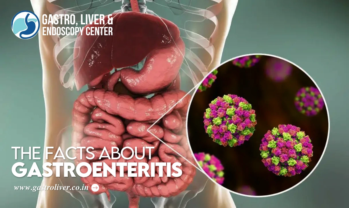 The Facts about Gastroenteritis