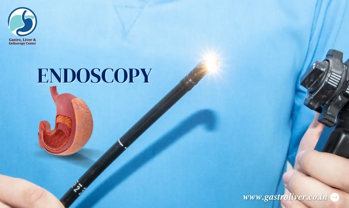 The Role of Endoscopy in the Evaluation of Abdominal Pain: A Comprehensive Guide