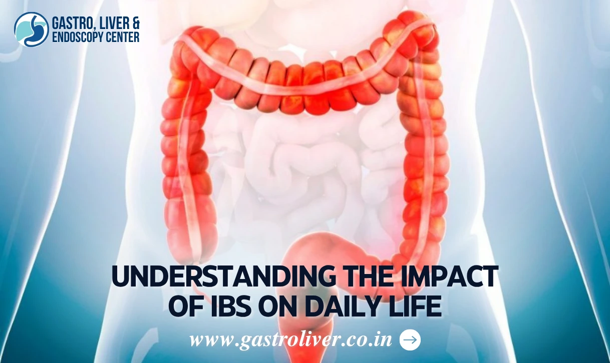 Understanding the Impact of IBS on Daily Life