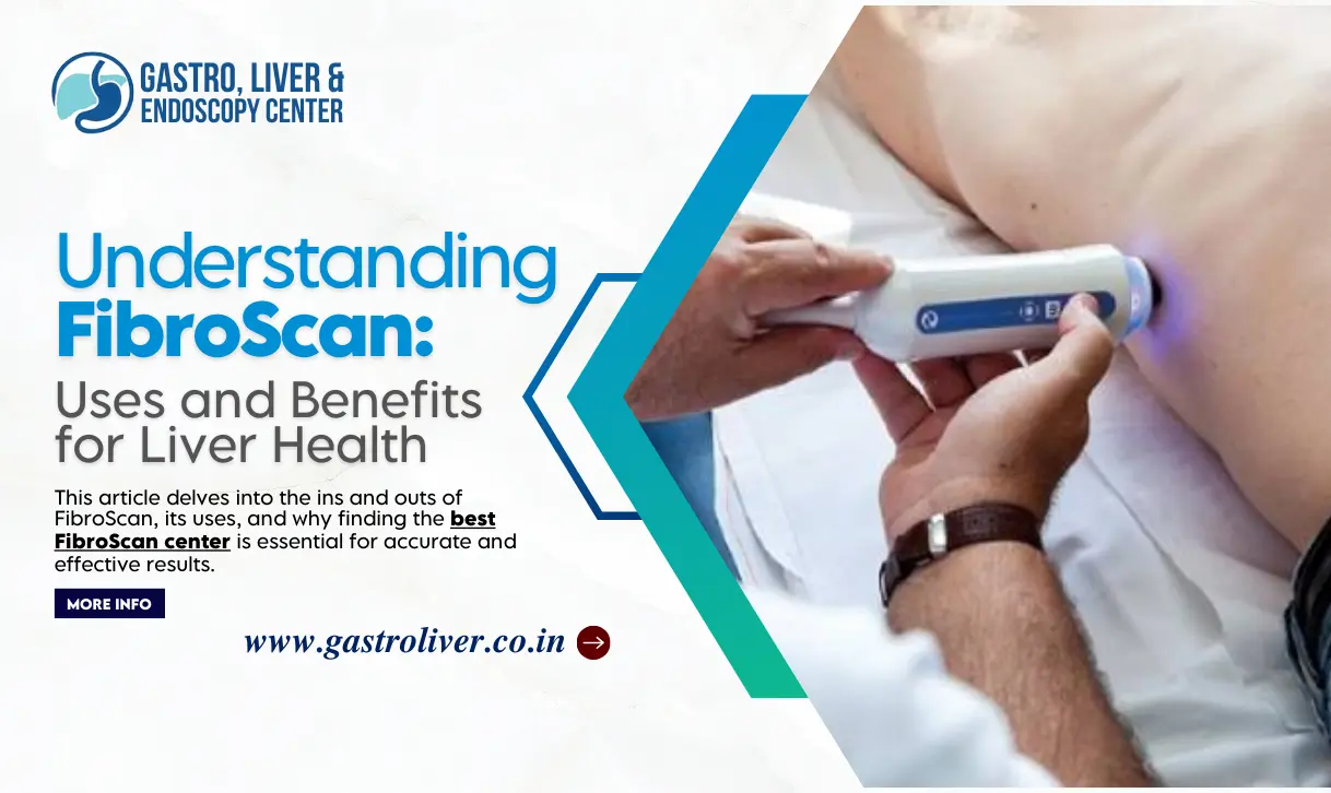 Understanding FibroScan: Uses and Benefits for Liver Health
