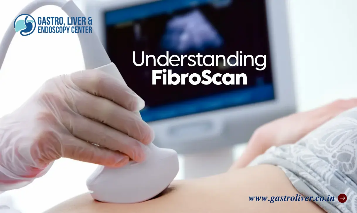 Understanding FibroScan: Uses and Benefits for Liver Health