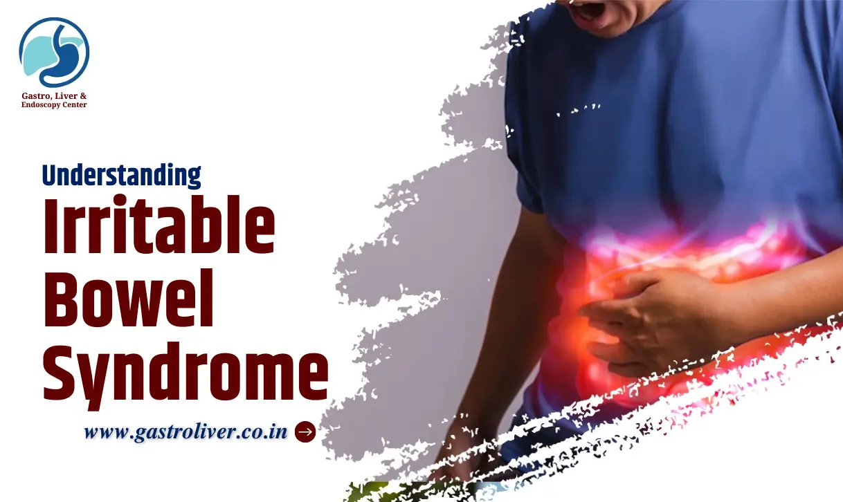 Understanding Irritable Bowel Syndrome