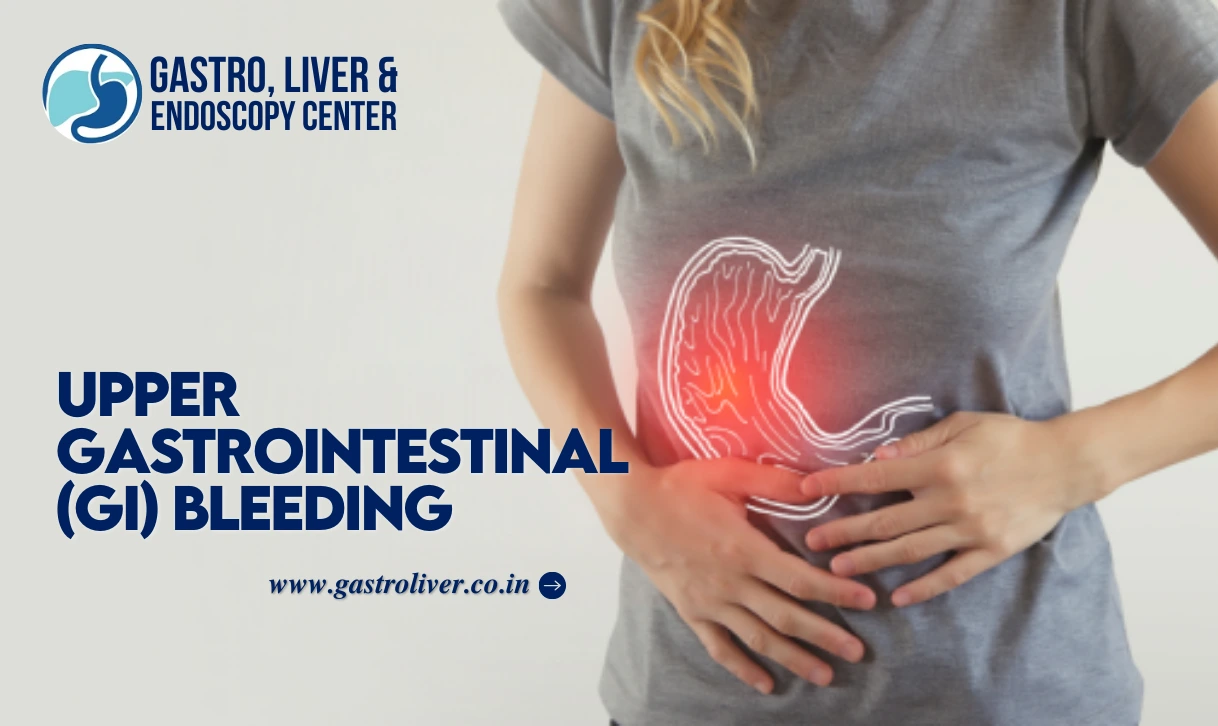 Upper Gastrointestinal (GI) Bleeding: Symptoms, Causes, Diagnosis, Prevention, and Treatment