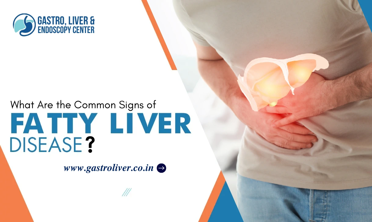 What Are the Common Signs of Fatty Liver Disease?