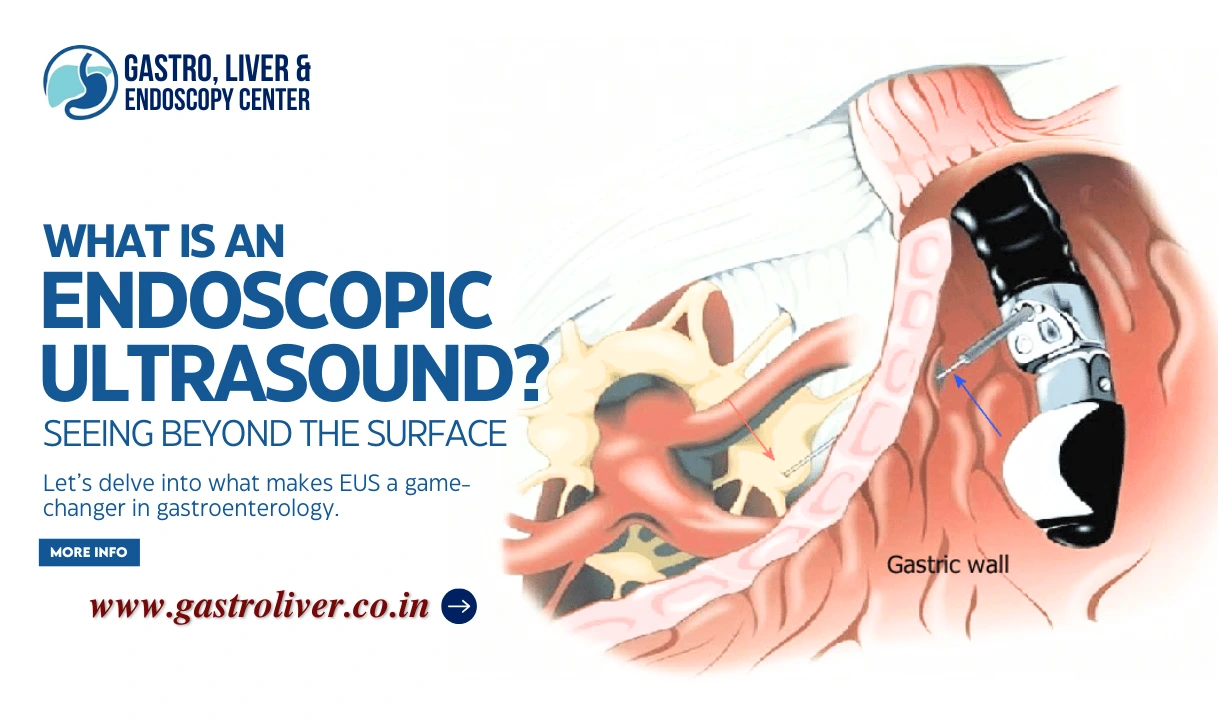 What is an Endoscopic Ultrasound? Seeing Beyond the Surface