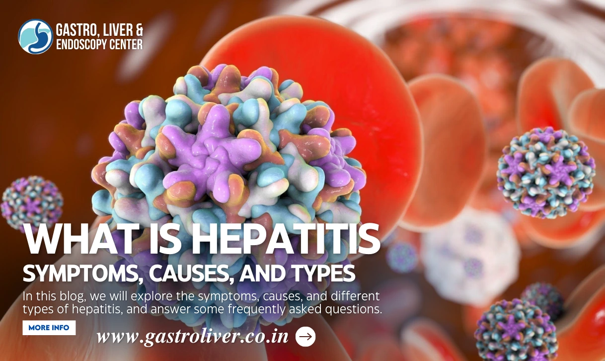 What is Hepatitis: Symptoms, Causes, and Types