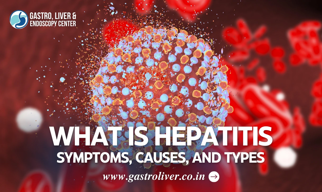 What is Hepatitis: Symptoms, Causes, and Types