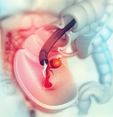 Colonoscopy - Best Doctor for Gastroenterology in Ghaziabad, Noida Extension