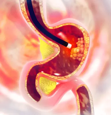 Endoscopy - Top/Best Endoscopy Clinic at Indirapuram/Ghaziabad, Uttar Pradesh