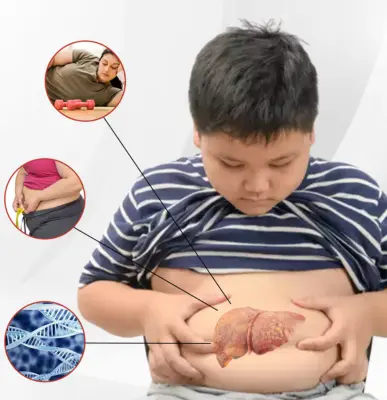 Fatty Liver - Top 10 Gastroenterologist in Ghaziabad