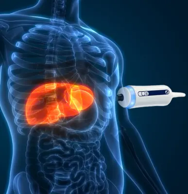 Fibroscan - Fibroscan Liver Test Clinic in Ghaziabad